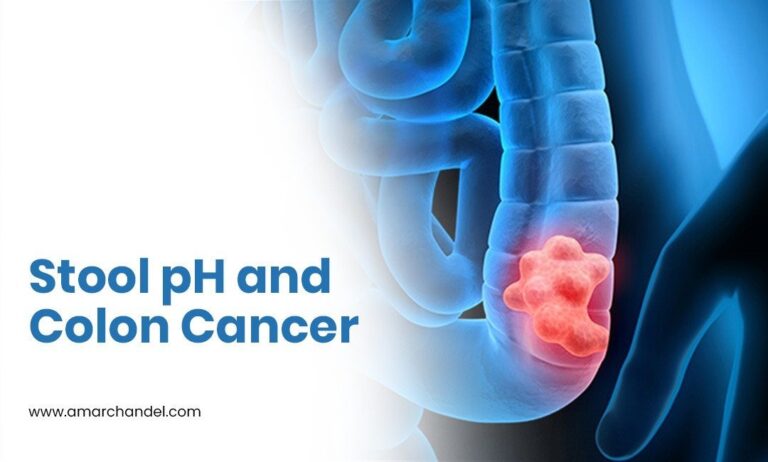 Stool pH and Colon Cancer