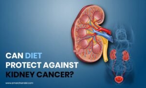 Can Diet Protect Against Kidney Cancer?