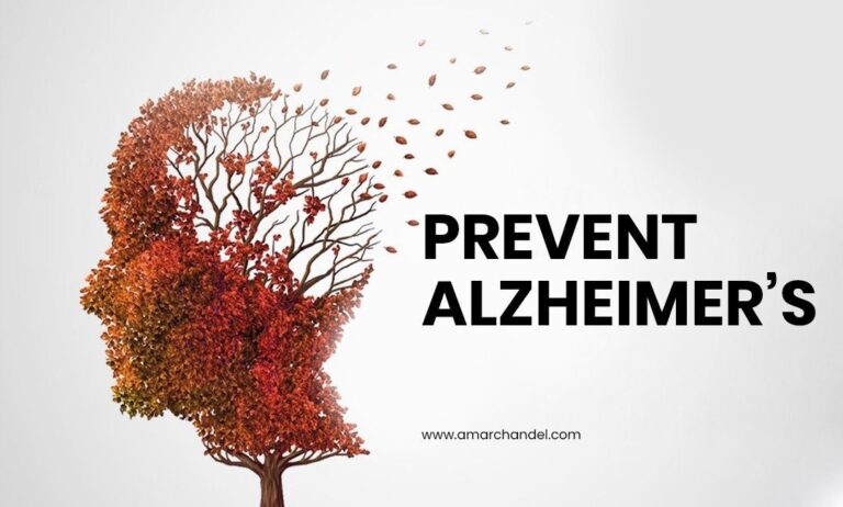 Prevent Alzheimer’s