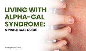 Living with Alpha-gal Syndrome: A Practical Guide