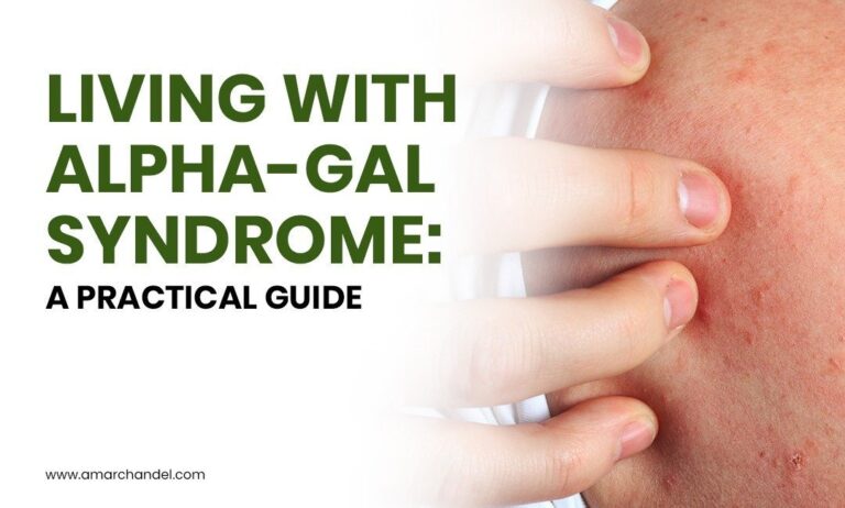 Living with Alpha-gal Syndrome: A Practical Guide