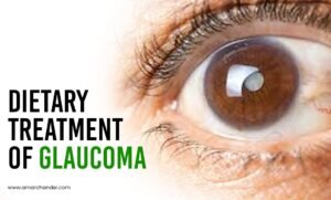 Dietary Treatment of Glaucoma