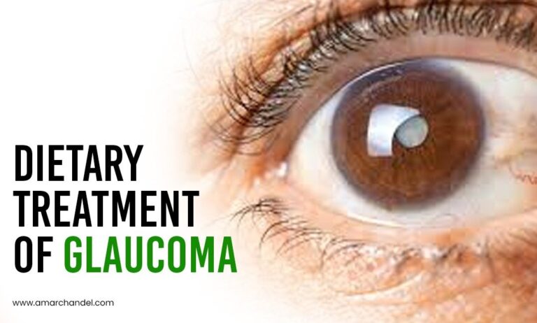 Dietary Treatment of Glaucoma