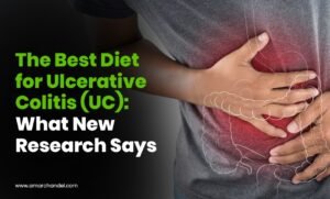 The Best Diet for Ulcerative Colitis (UC): What New Research Says