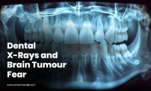 Dental X-Rays and Brain Tumour Fear
