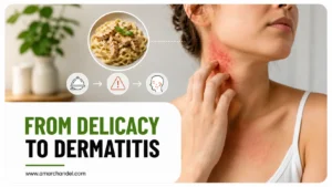 From Delicacy to Dermatitis