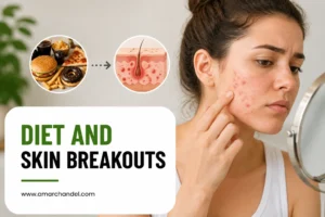 Diet And Skin Breakouts